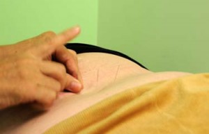 Acupuncture Needle Insertion